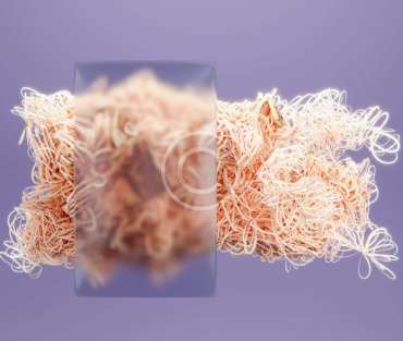 Tangled Threads